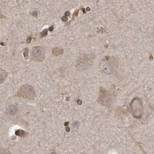 Anti-CEP350 antibody produced in rabbit 
