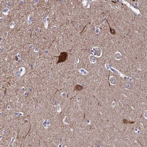 Anti-CEP41 antibody produced in rabbit 