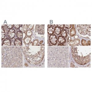 Anti-CEP70 antibody produced in rabbit 