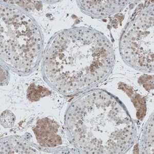 Anti-CERS3 antibody produced in rabbit 
