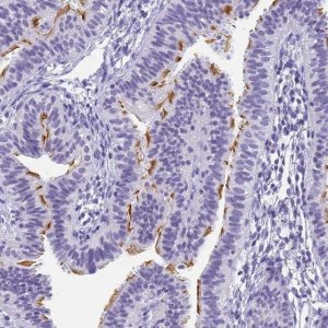Anti-CFAP100 antibody produced in rabbit 