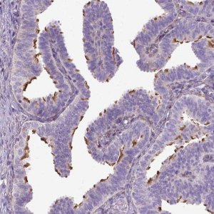 Anti-CFAP157 antibody produced in rabbit 