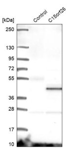 Anti-CFAP161 antibody produced in rabbit 