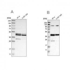 Anti-CFAP36 antibody produced in rabbit 