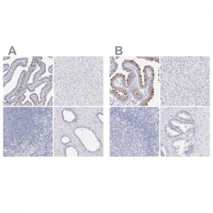 Anti-CFAP57 antibody produced in rabbit 