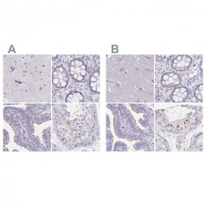 Anti-CFAP74 antibody produced in rabbit 