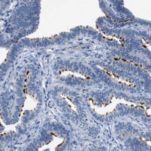 Anti-CFAP77 antibody produced in rabbit 