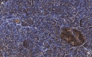 Anti-CFTR Antibody, clone 1C22 ZooMAb Rabbit Monoclonal 