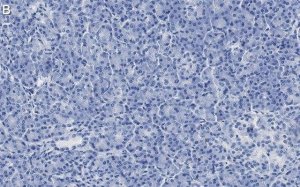 Anti-CFTR Antibody, clone 1C22 ZooMAb Rabbit Monoclonal 