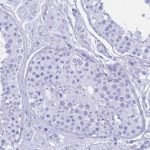 Anti-CGB3 antibody produced in rabbit 