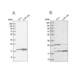 Anti-CGGBP1 antibody produced in rabbit 
