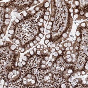 Anti-CGGBP1 antibody produced in rabbit 