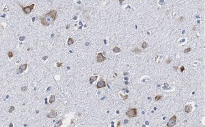 Anti-CGRP-1 Antibody, clone 2E18 ZooMAb Rabbit Monoclonal 