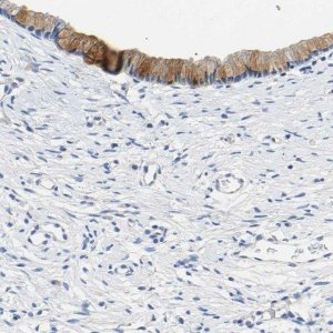 Anti-CHAD antibody produced in rabbit 