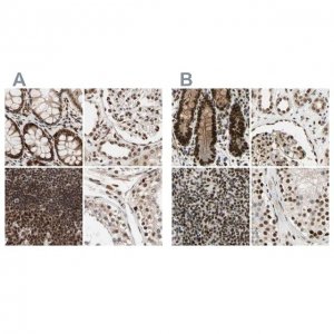Anti-CHAMP1 antibody produced in rabbit 