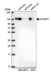 Anti-CHAMP1 antibody produced in rabbit 