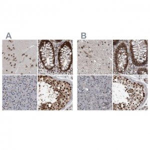 Anti-CHD1L antibody produced in rabbit 