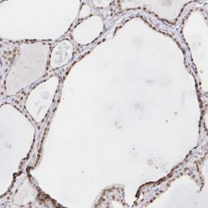 Anti-CHD2 antibody produced in rabbit 