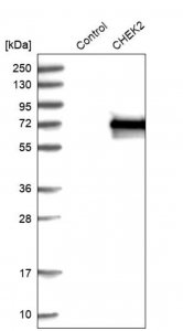 Anti-CHEK2 antibody produced in rabbit 