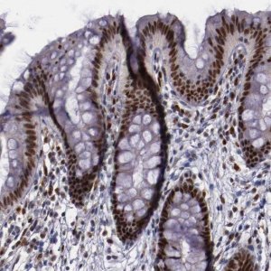 Anti-CHEK2 antibody produced in rabbit 