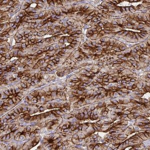 Anti-CHGA antibody produced in rabbit 