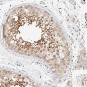 Anti-CHKA antibody produced in rabbit 