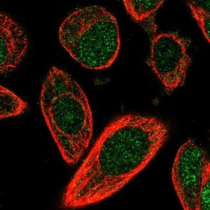 Anti-CHML antibody produced in rabbit HPA029627-100UL