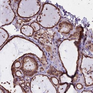 Anti-CHMP2A antibody produced in rabbit 