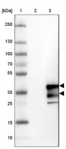 Anti-CHMP3 antibody produced in rabbit 