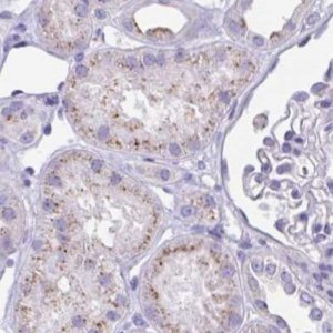 Anti-CHMP5 antibody produced in rabbit 