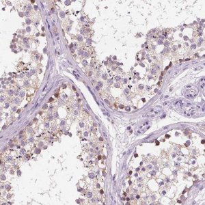 Anti-CHODL antibody produced in rabbit 