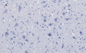 Anti-Choline Acetyltransferase (ChAT) Antibody, clone 2K16, ZooMAb Rabbit Monoclonal 