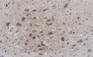 Anti-Choline Acetyltransferase (ChAT) Antibody, clone 2K16, ZooMAb Rabbit Monoclonal 