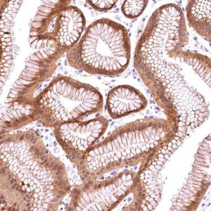 Anti-CHORDC1 antibody produced in rabbit 