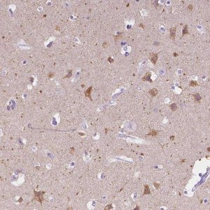 Anti-CHRM1 antibody produced in rabbit 