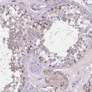 Anti-CHST3 antibody produced in rabbit 