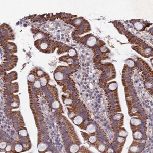 Anti-CHST5 antibody produced in rabbit 
