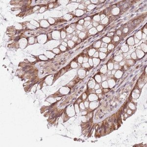 Anti-CHURC1 antibody produced in rabbit 