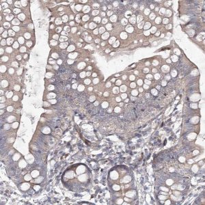 Anti-CIB2 antibody produced in rabbit 