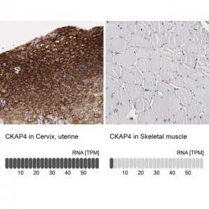 Anti-CKAP4 antibody produced in rabbit 