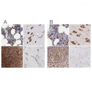 Anti-CKAP4 antibody produced in rabbit 