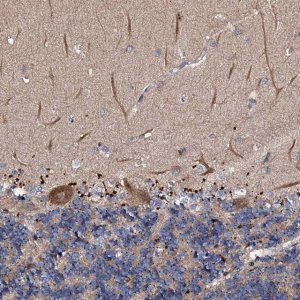 Anti-CKAP5 antibody produced in rabbit 
