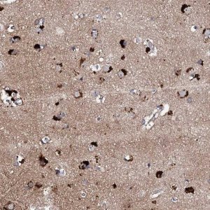 Anti-CKAP5 antibody produced in rabbit 
