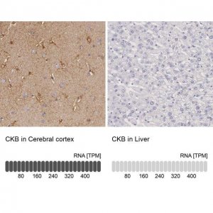 Anti-CKB antibody produced in rabbit 