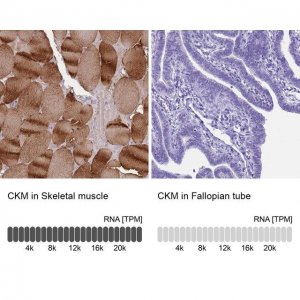 Anti-CKM antibody produced in rabbit 