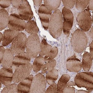 Anti-CKM antibody produced in rabbit 