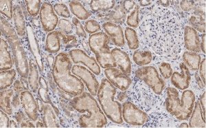 Anti-Claudin 6 Antibody, clone 1B22 ZooMAb Rabbit Monoclonal 