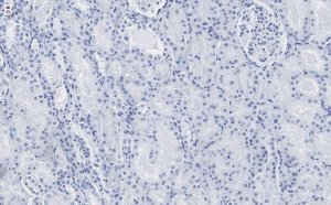 Anti-Claudin 6 Antibody, clone 1B22 ZooMAb Rabbit Monoclonal 