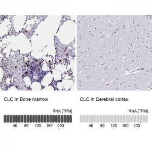 Anti-CLC antibody produced in rabbit 