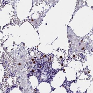 Anti-CLC antibody produced in rabbit 